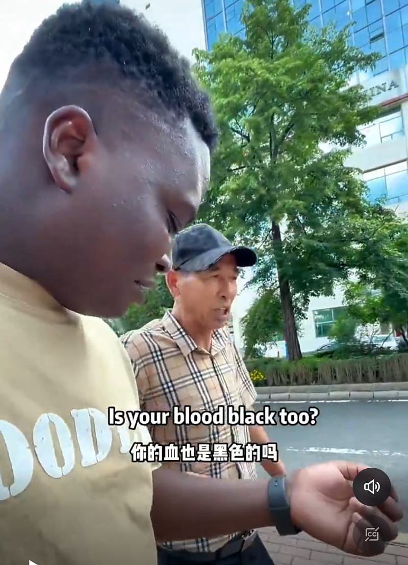 인종차별이다 vs 그냥 멍청해서 물어본거다