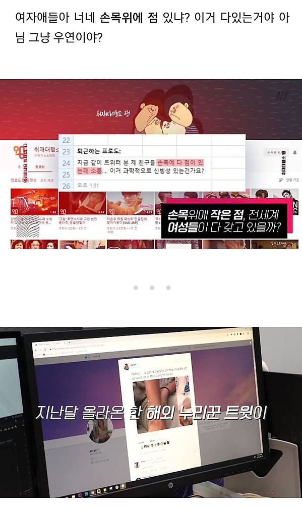 여자들은 전부 손목에 까만 점이 있다는데 사실일까?