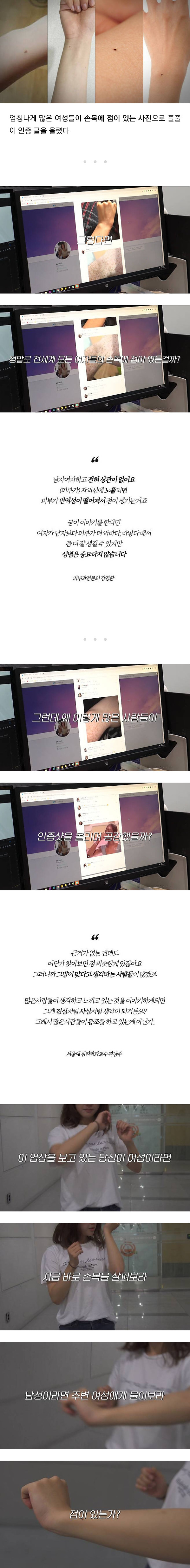 여자들은 전부 손목에 까만 점이 있다는데 사실일까?